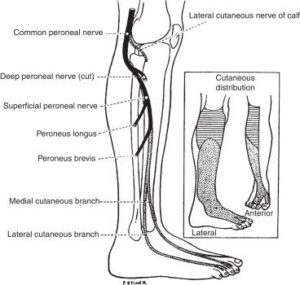 The Perineal Nerve: How a Single Leg Kick Can Change the Outcome of a Fight