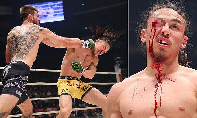 Pretty Much Lost His Eye’ – Former UFC Champs Expose Shocking Eye Injury Risks in MMA After UFC 321 Controversy Pretty Much Lost His Eye’ – Former UFC Champs Expose Shocking Eye Injury Risks in MMA After UFC 321 Controversy